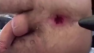 Permanently destroying my tight teen asshole